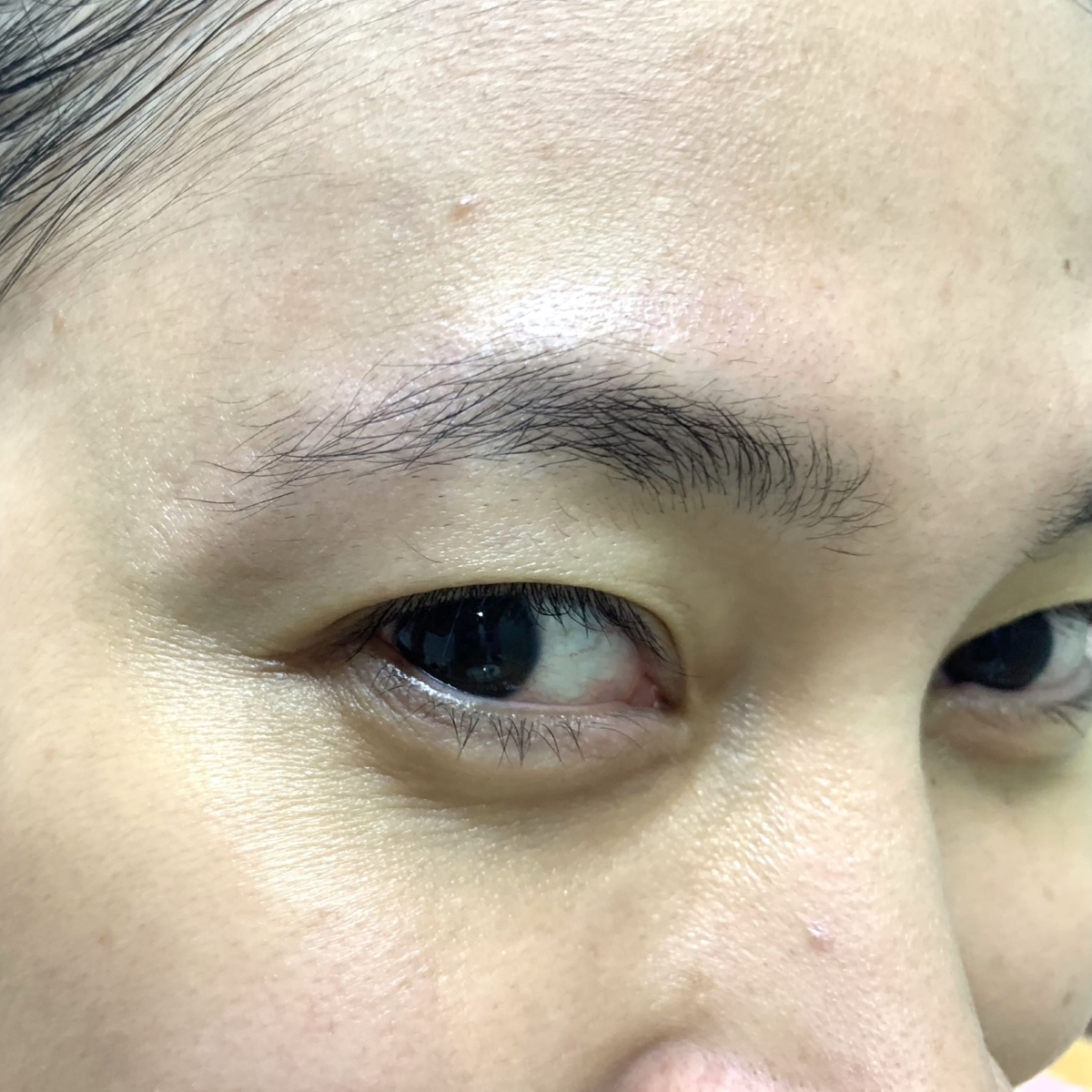 Before using Beauty of Joseon Revive Eye Serum: Ginseng + Retinal