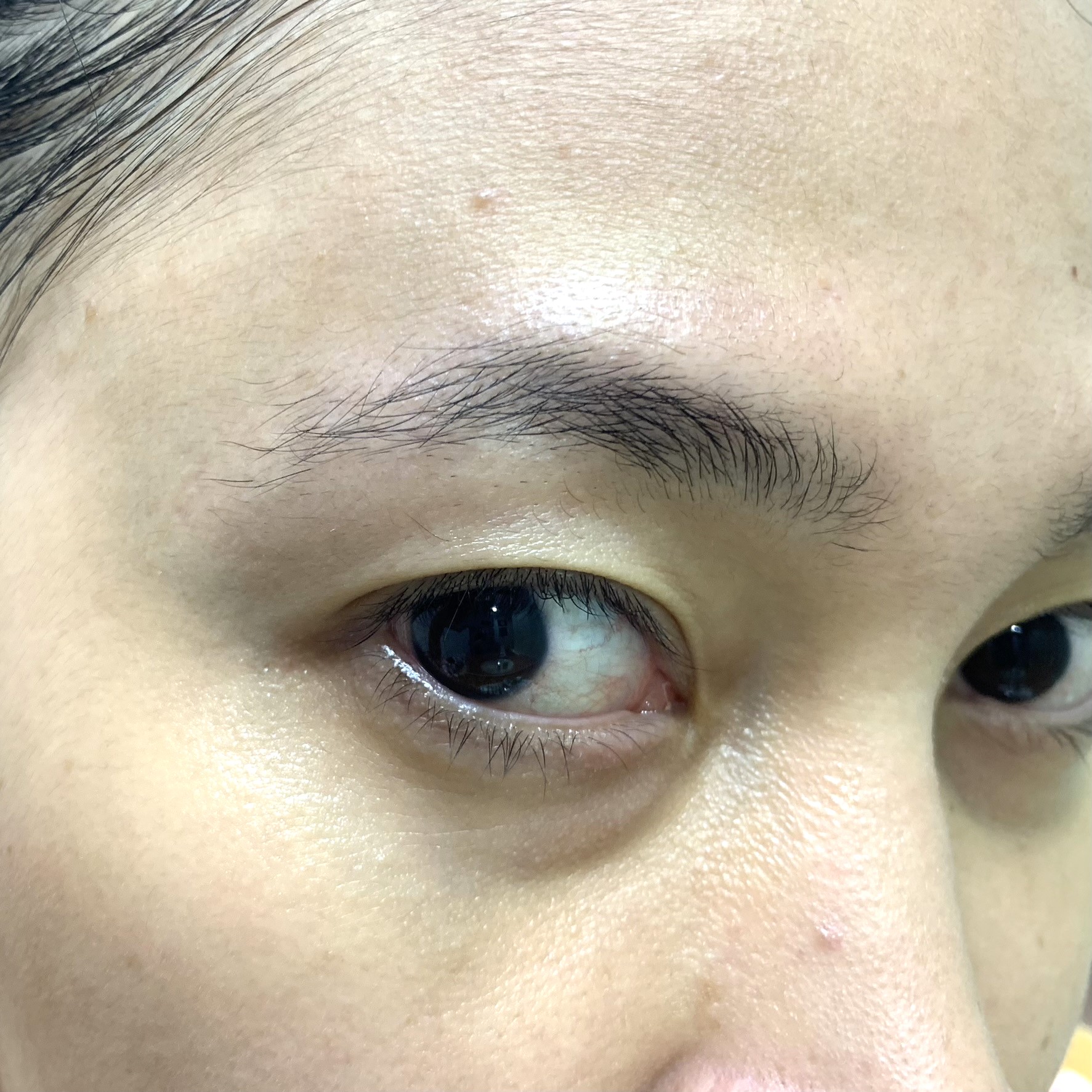 Before using Beauty of Joseon Revive Eye Serum: Ginseng + Retinal